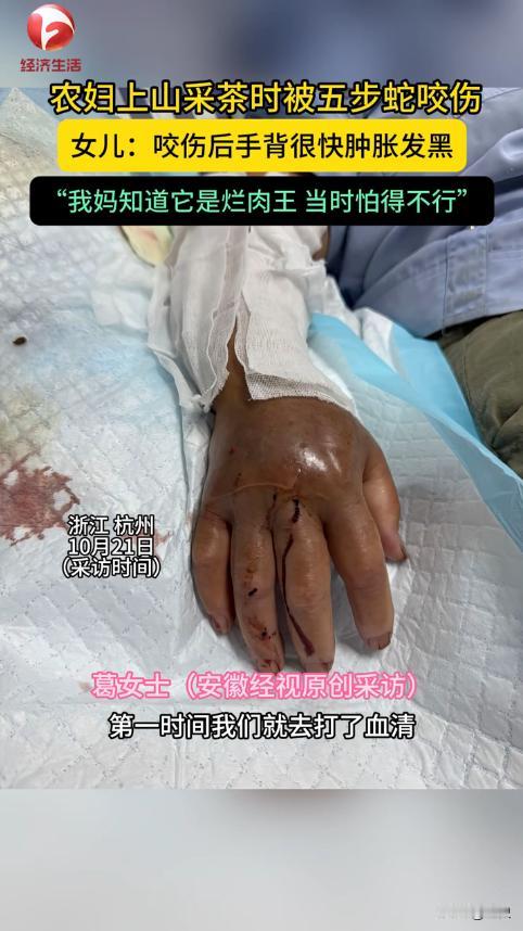“悲剧还是发生了！”据媒体10月21日的报道，浙江杭州，一女子上山采茶叶时，忽然
