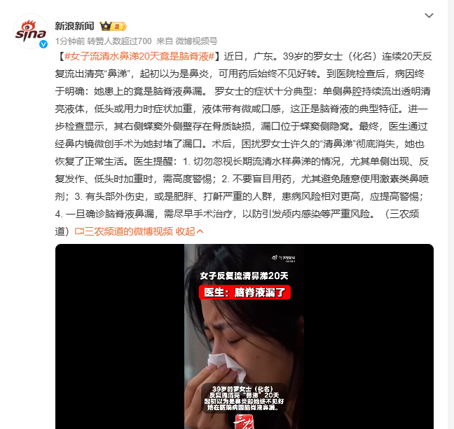 女子流清水鼻涕20天竟是脑脊液 39岁罗女士在广东连续20天反复流清亮“鼻涕”，