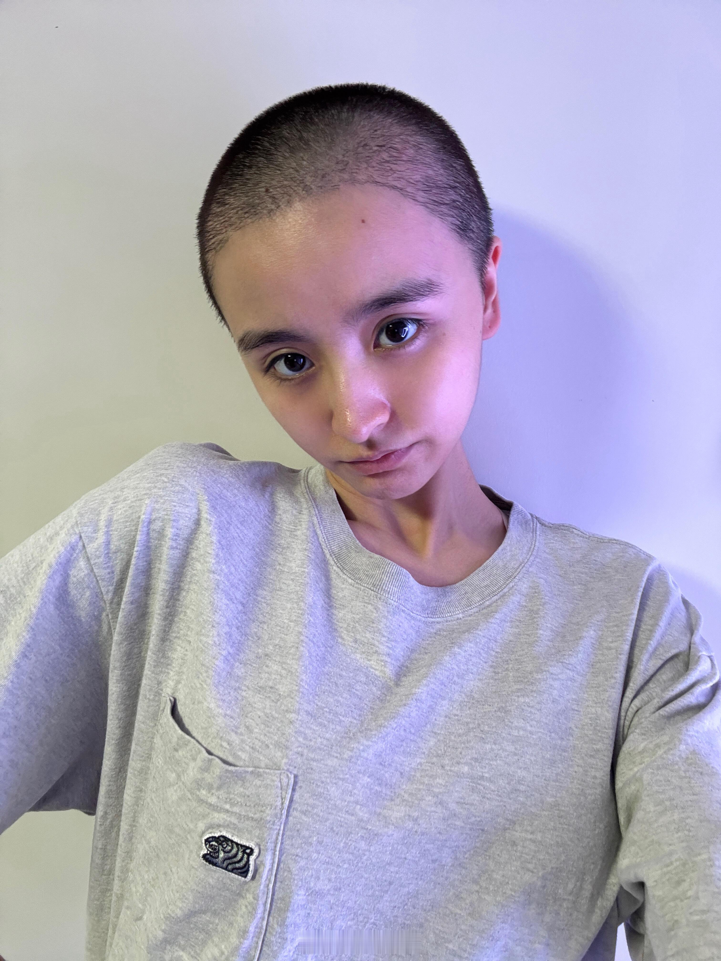 金子涵退圈原因疑似是抑郁症😔现在直接把头发剃成光头了[吃惊] ​​​