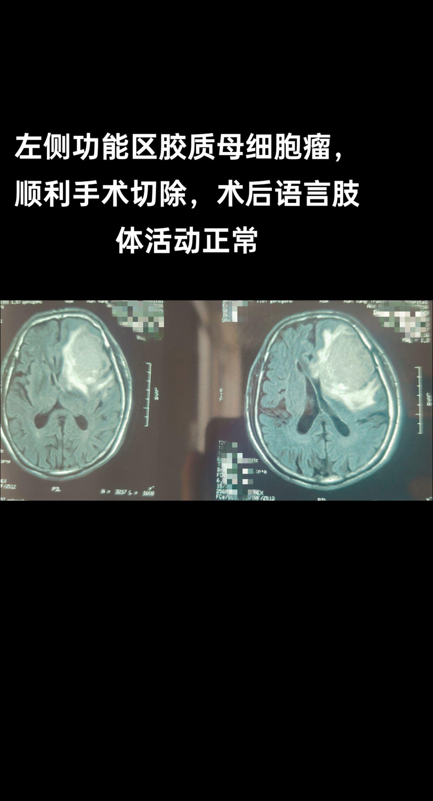 手术室日常 医路前行 医路有你