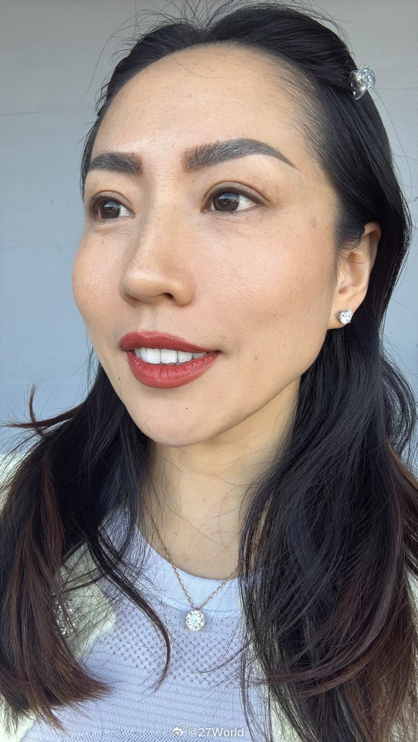 全民运动flag大会 【46+姐姐聊聊近期过敏症状】2月26号生日还打扮漂漂亮亮