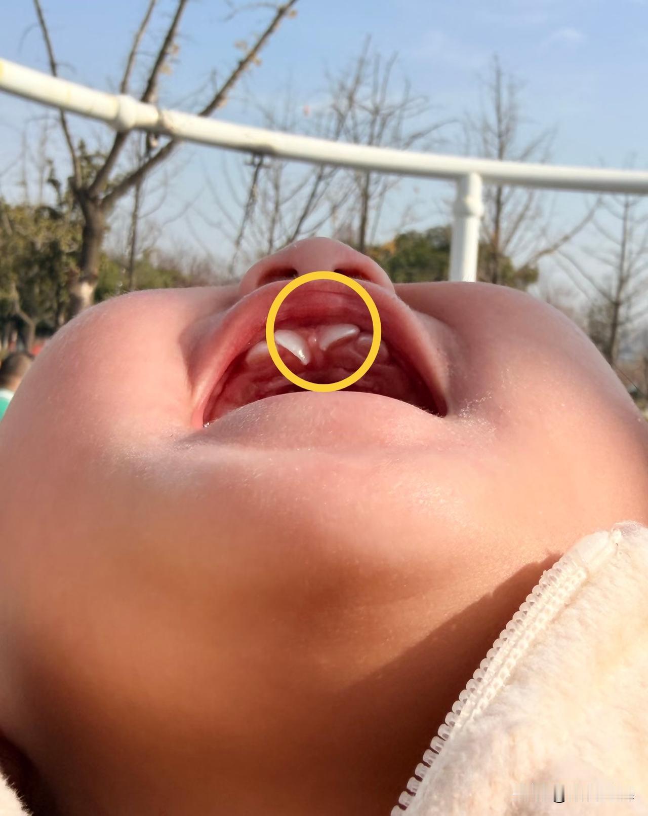 亲戚家娃1岁2个月，这出牙路简直是“慢动作+奇幻片”：9个月才慢悠悠开始长牙，还