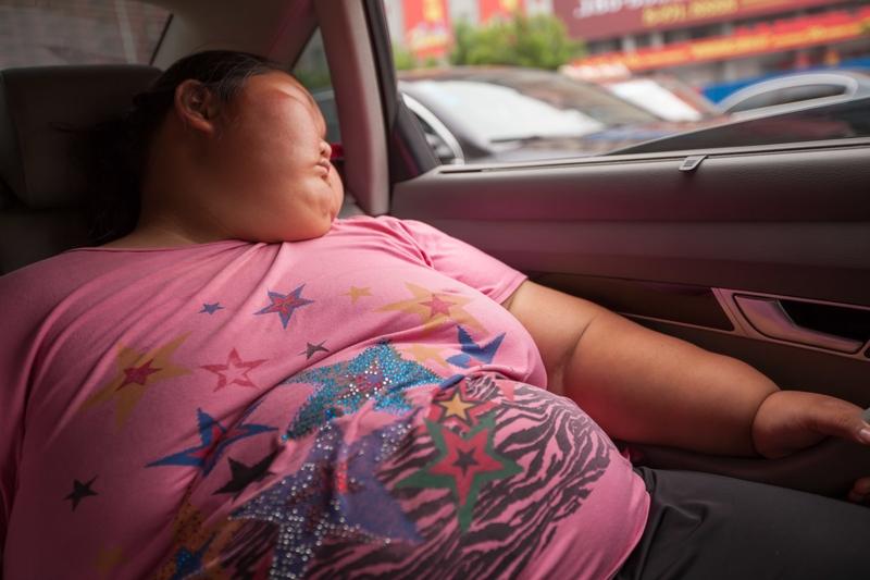 80多斤女生嫌胖打超量减肥针，进ICU抢救！病态审美害了多少人
 
疯了！80多