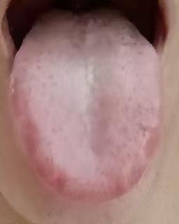 舌有齿痕状态欠佳？健脾养血提振精气神







为什么关键时刻总是习惯性的见