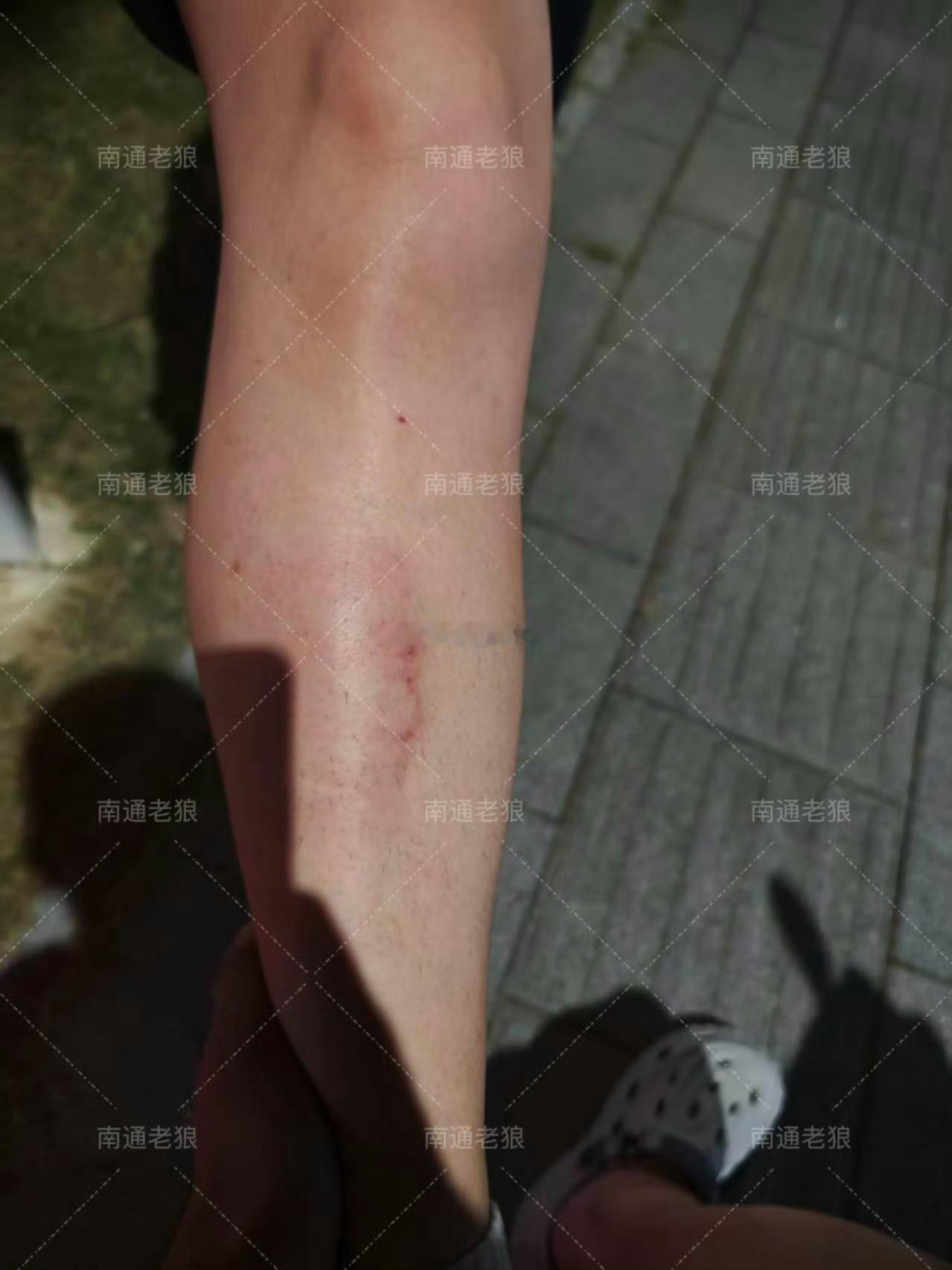 南通爆料 网友投稿：南通滨江花海入口，警示桩竟然直接拉钢丝绳？！晚上散步根本看不