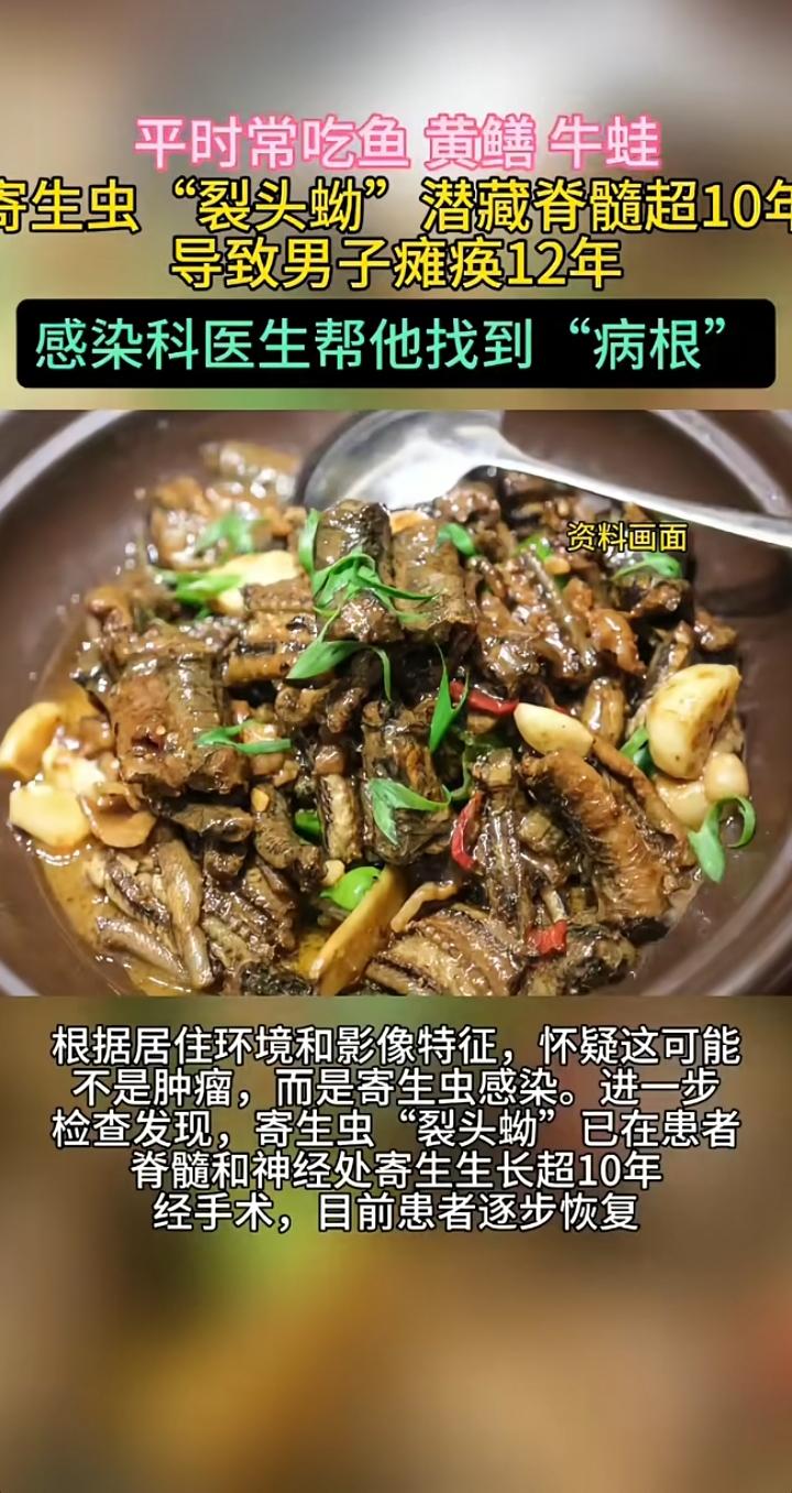 12年瘫痪，竟因吃出来的“隐形杀手”
 
广东55岁的宋先生，被怪病缠了整整12