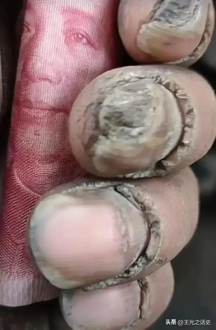 它让我想起皲裂的大地，一朵朵花嗷嗷待哺
​每一条缝隙里，藏着被当代屏蔽的绝望
​