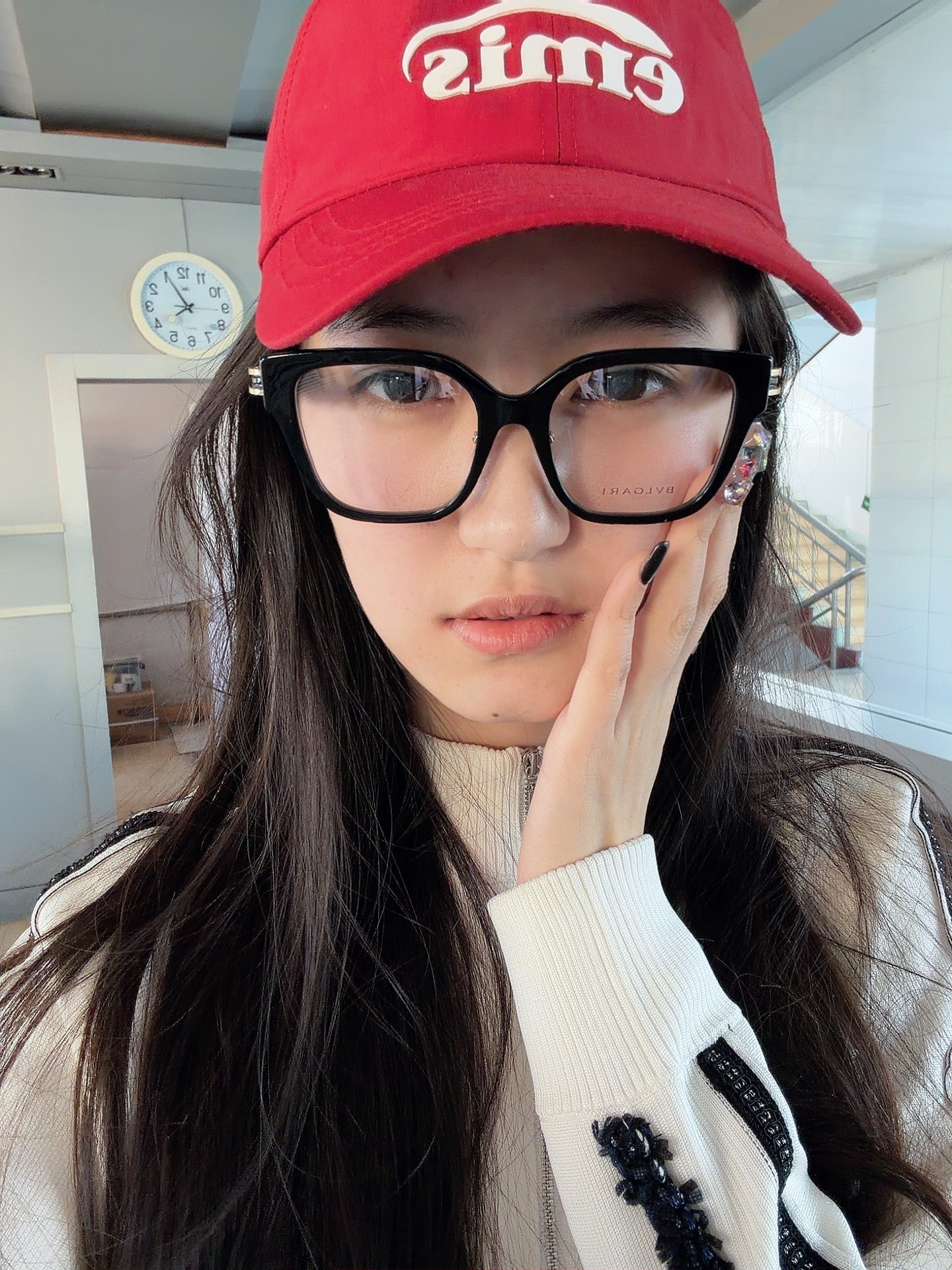 🦷麻药打之后拥有厚嘴唇和大肿脸琪天大圣 枣庄