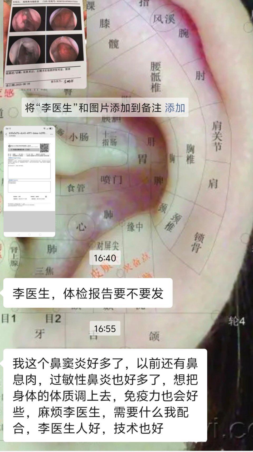 过敏性鼻炎，鼻窦炎，打喷嚏鼻子痒，鼻涕倒流，嗅觉差，胆囊息肉各种结节。经过中药治