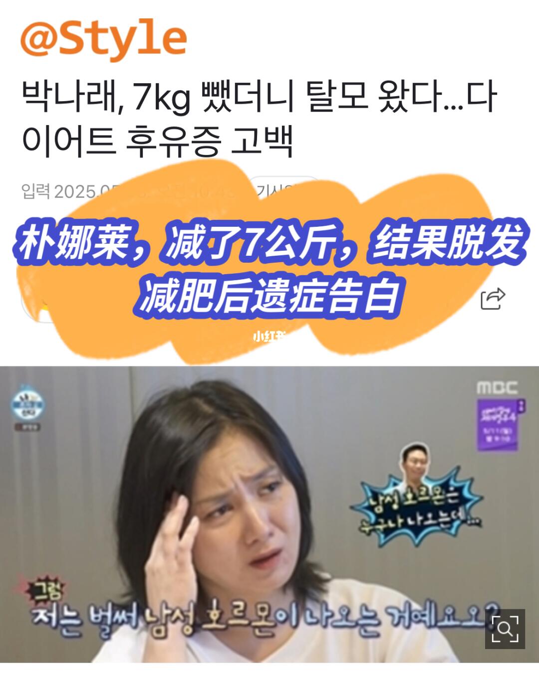 🔥朴娜莱，减了7kg结果脱发…减肥后遗症告白