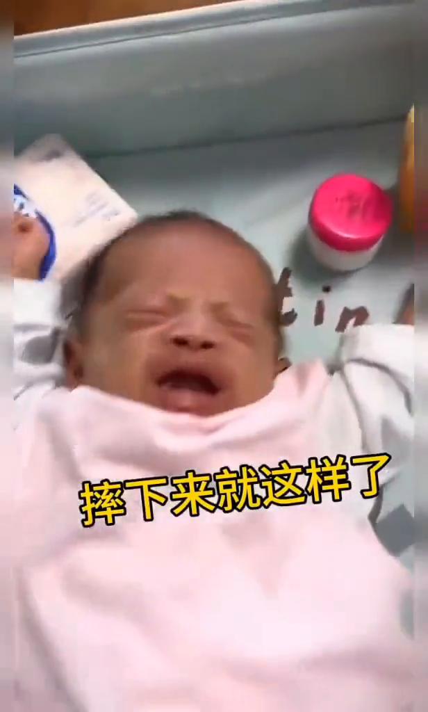 摔下来就这样了。