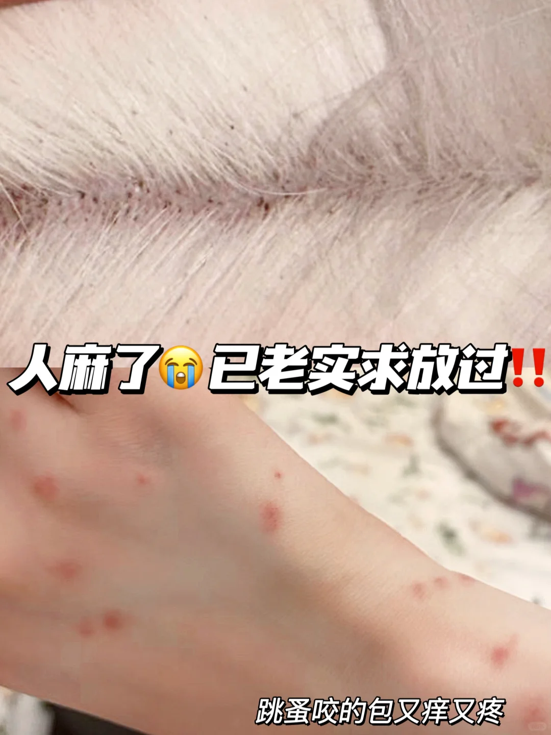 跳蚤能不能消失在地球上啊‼️