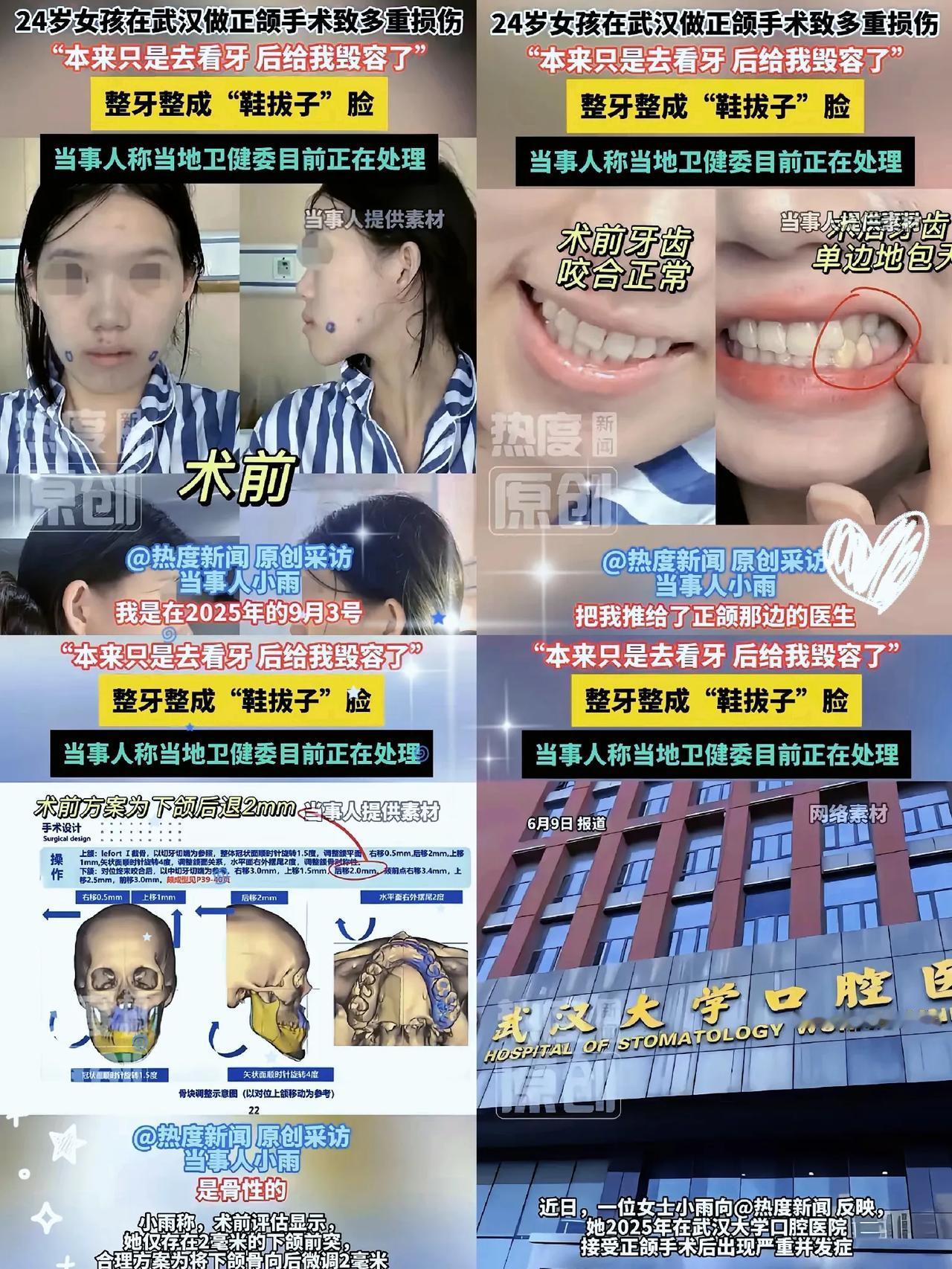 武汉小雨姑娘这遭遇，听着都让人揪心！

本想补个牙、整整牙，结果被武大口腔医院医