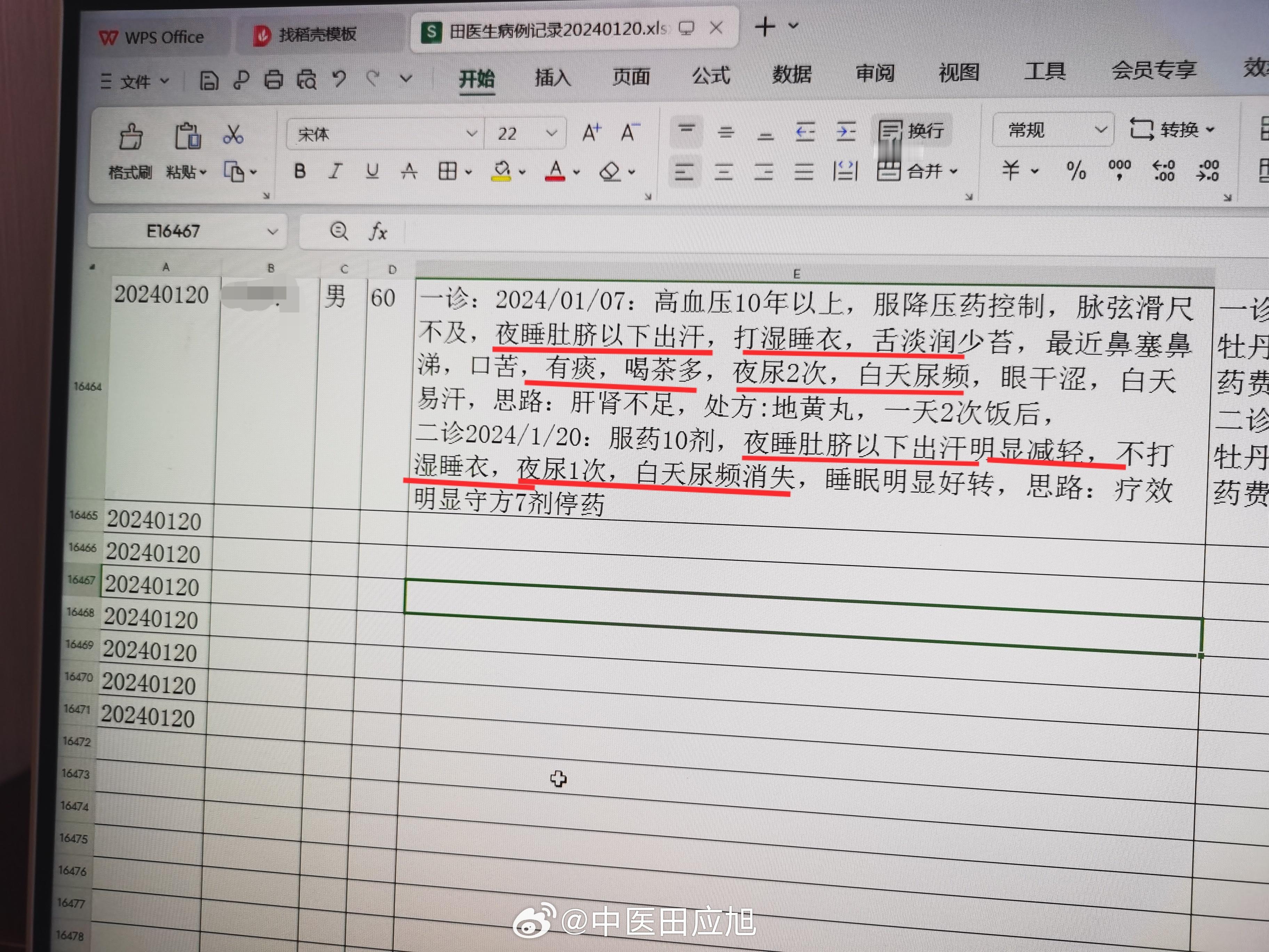 #中医# 发点冷门案例 男 60岁 夜睡肚脐以下半身异常多汗，打湿睡衣床单，白天