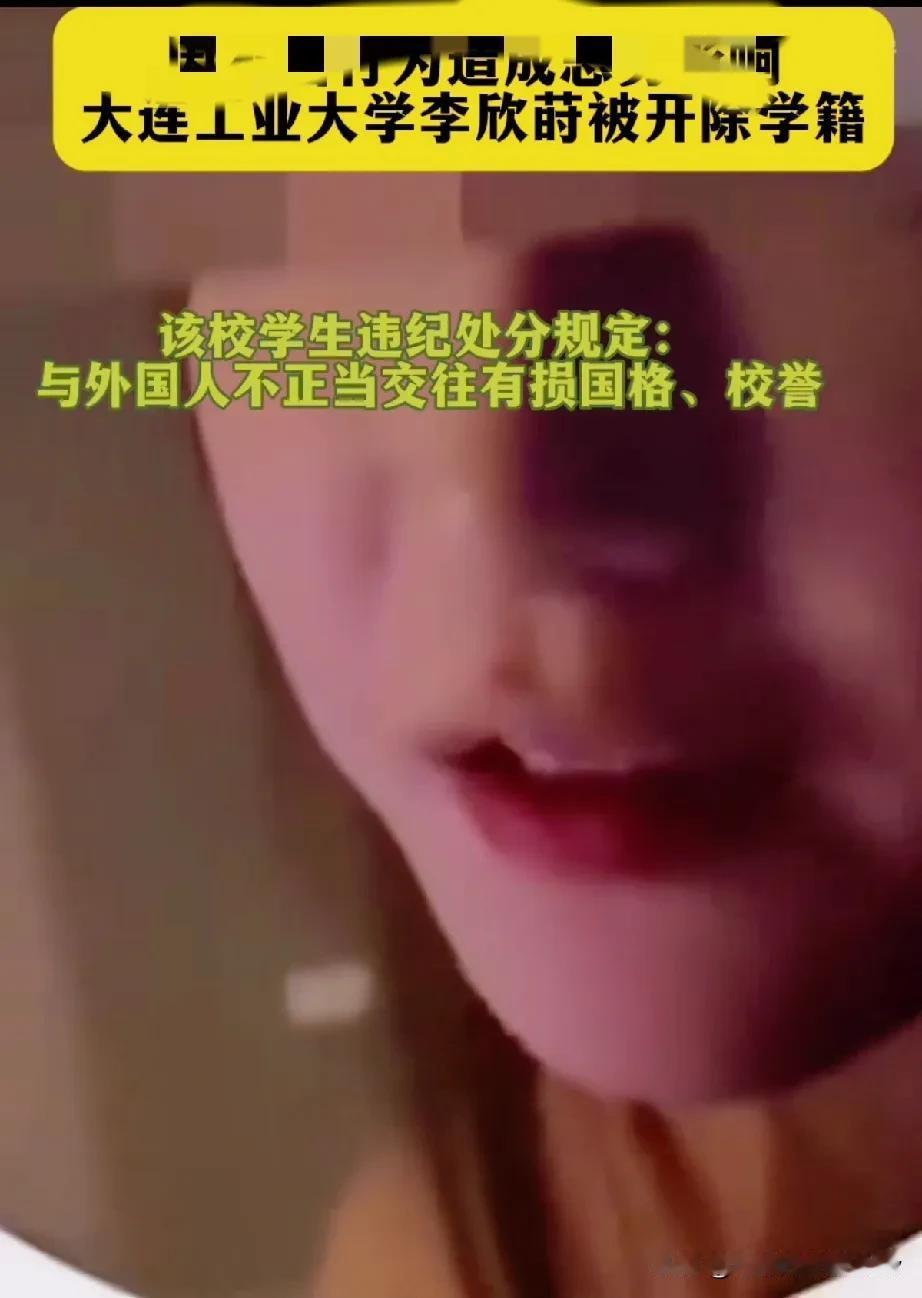 “与外国人发生不正当行为，有损国格，校誉。”这条，值得各大学各单位借鉴学习。
让