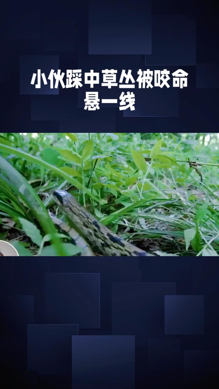 26岁青年踩中蛇窝，被三条以上毒蛇连咬十余口，生命垂危。
5月14日，云南滇西边