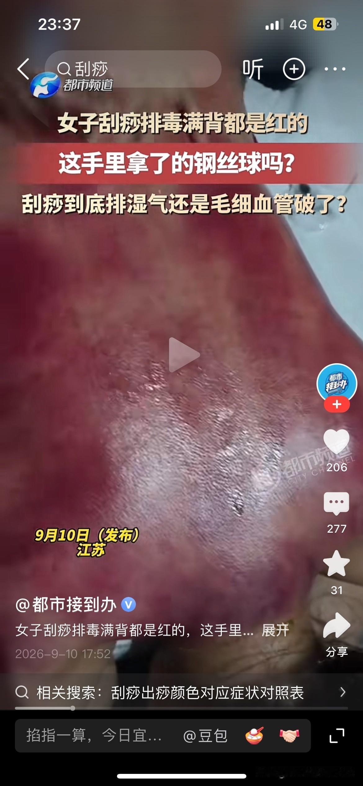 这哪里是刮什么痧，这就是愚昧无知花钱买罪受。
很多愚昧无知的人动不动就说自己体内