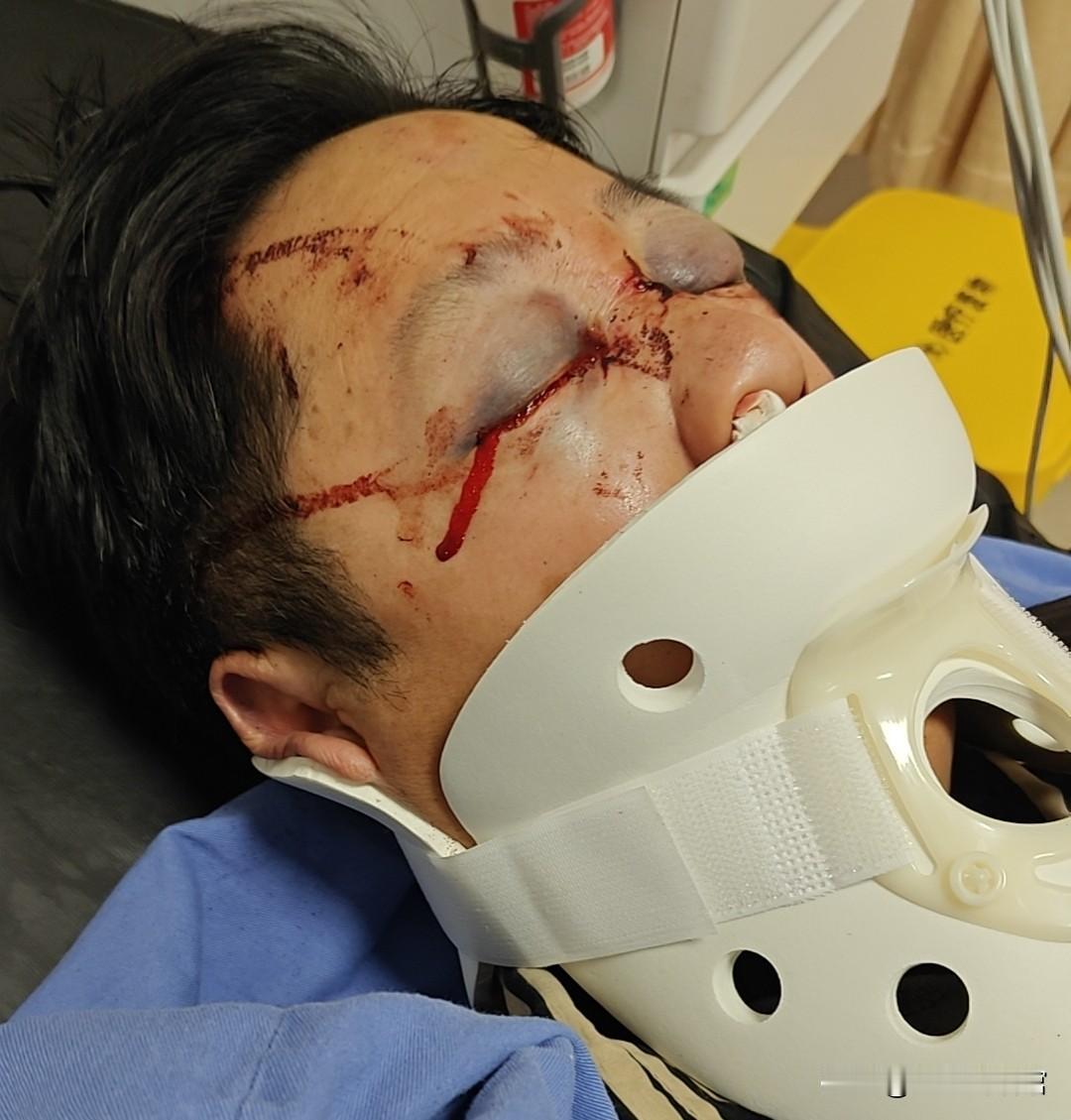 意外遇暖，万幸遇见有担当的人
 
老公骑电摩撞上路边大货车受伤，正满心焦灼无措时