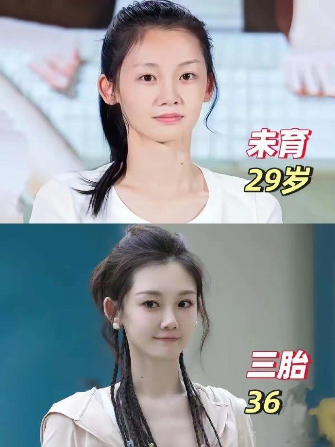 vocal，这就是频繁生育的代价吗 