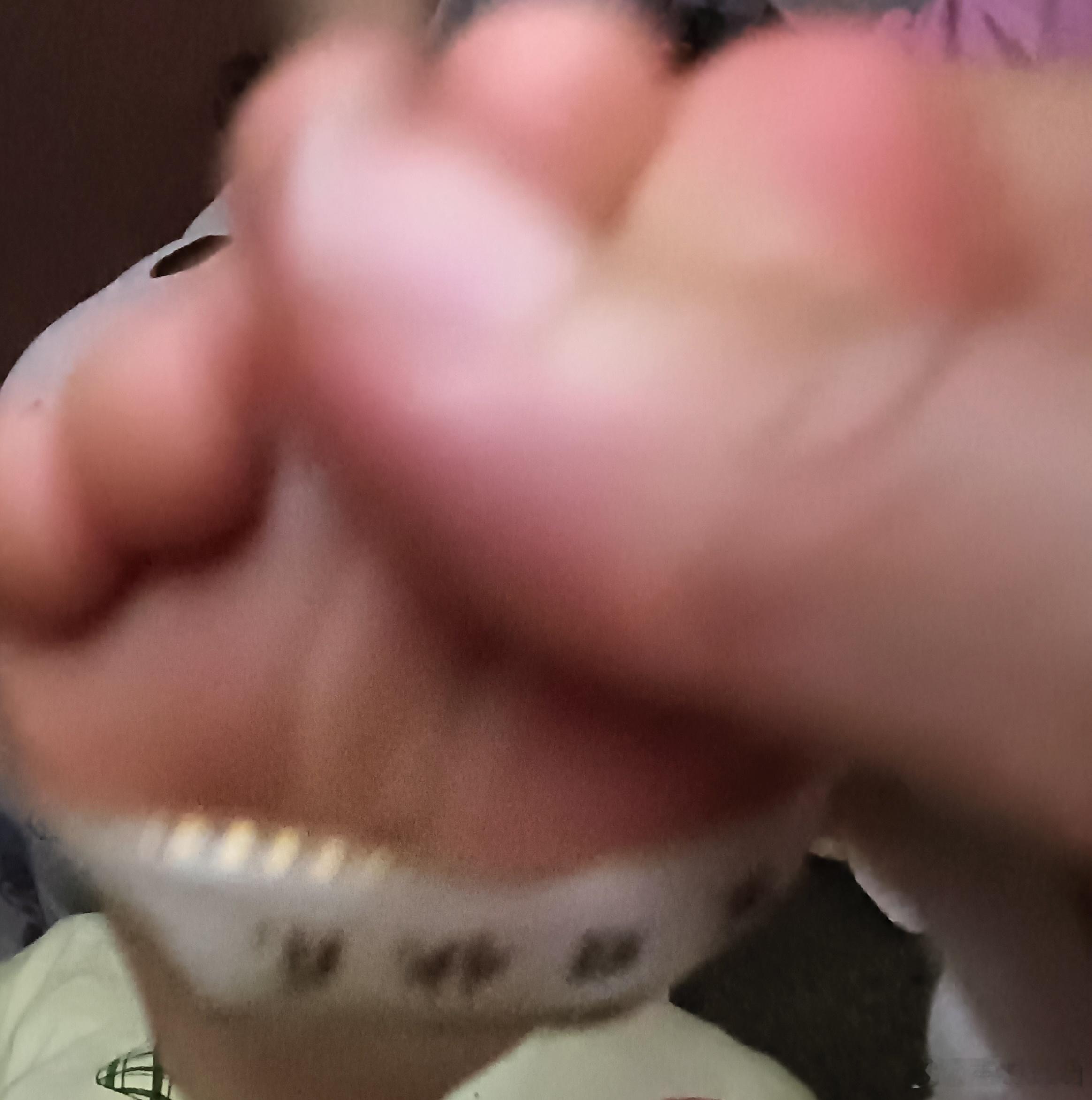这两天孩子有点咳嗽，昨晚上睡前给她贴的涌泉，早上起来左脚贴的掉了。孩子一醒来就问