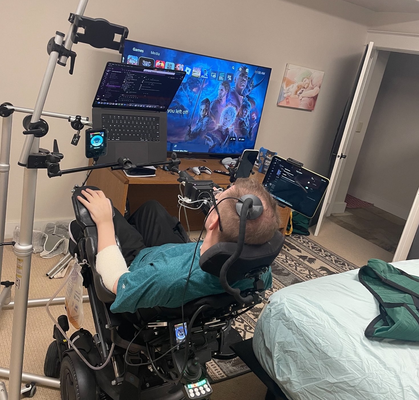 公开受试者虽才27例，但Neuralink人体试验的4条路已经铺开了截至9月19