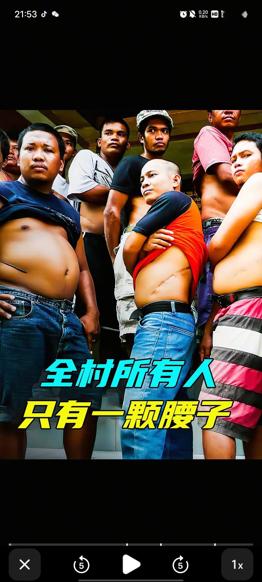 黑恶势力好可怕！
印度也有嘎腰子的“买卖”！
印度警方最近打掉了一个跨境的肾脏贩