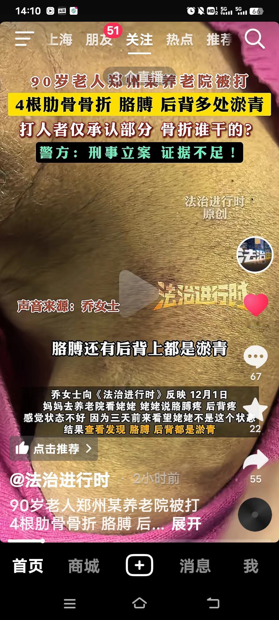 真是士可忍孰不可忍！一位90岁老人在郑州一家养老院被打，导致4根筋骨骨折，胳膊和