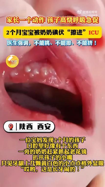 西安一位宝妈近期的经历，让不少新手家长绷紧了神经。家里2个月大的宝宝口腔内出现黄