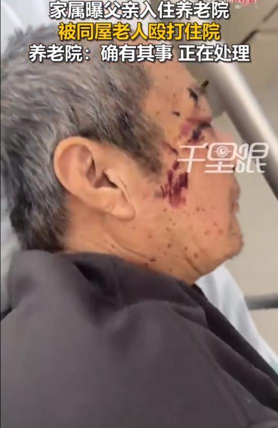 “必须严惩！”内蒙古赤峰，女子到养老院接父亲，却见父亲裤子裂开，上衣后背被撕烂，