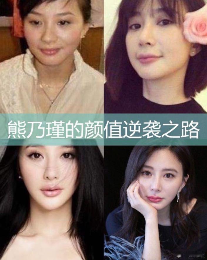 熊乃瑾回应整容内核坚定  在《演员请就位3》这犀利的提问环节，熊乃瑾被惠英红问整