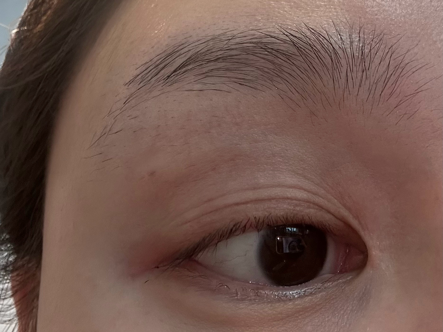 有没有成都💉医生推荐 真的不敢再急性子乱找人打了  给我打成毛毛虫了 [晕] 