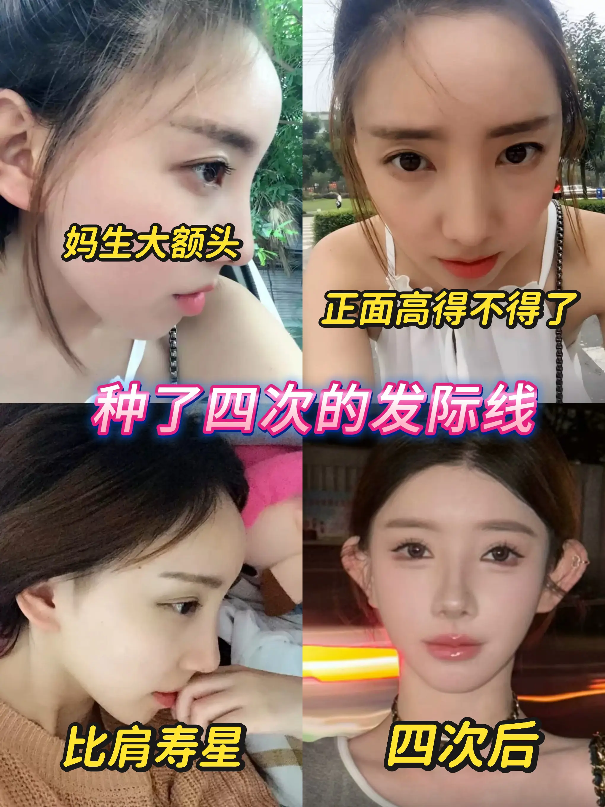 真的很突出，像寿星