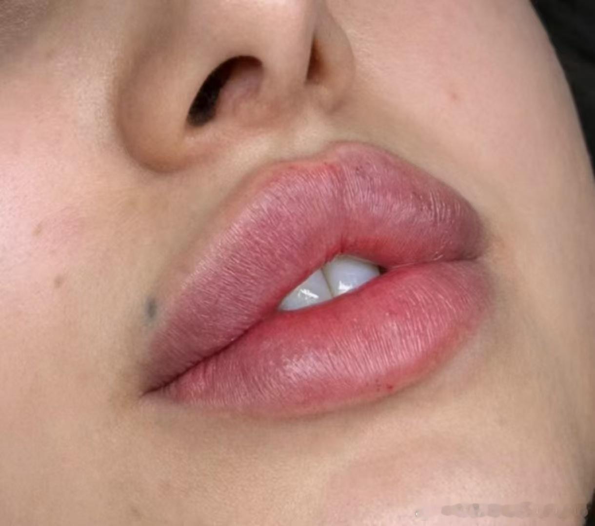 👄极限二选一？ 
