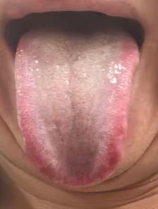 肝郁脾虚、湿热下注复合证型调理科普







近日有一位年轻粉丝咨询身体调养