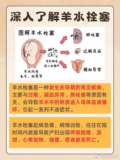 32岁产妇羊水栓塞成植物人  这医院太垃圾了，遇到“产科死神”“羊水栓塞”居然还