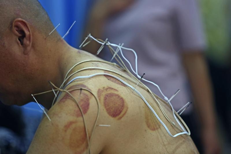 阳气不足，人会咋样？ 阳气不足，人可就遭老罪咯！从身体状况来说，阳气不足的人特别