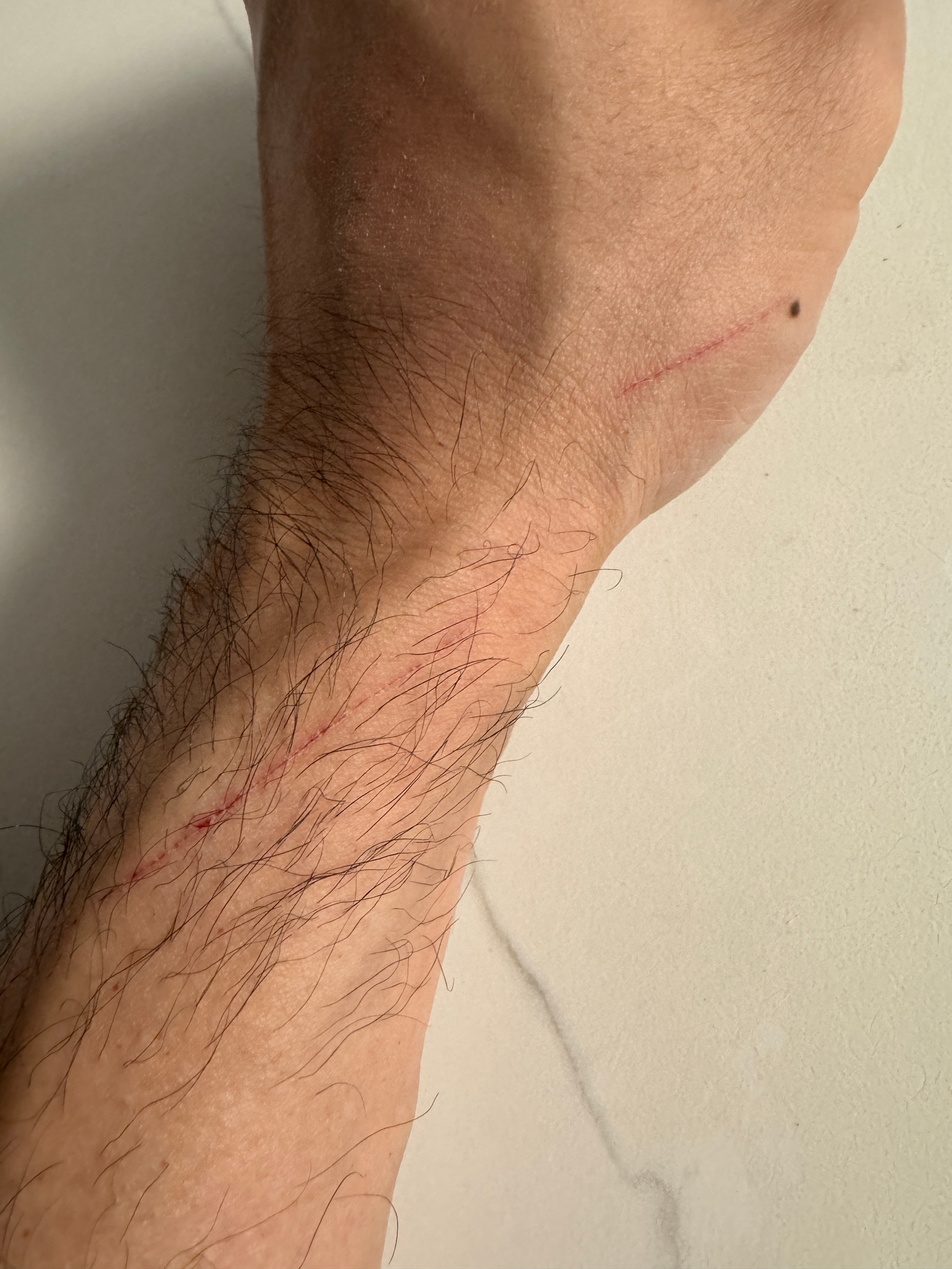 我问楼下的流浪猫你阉了吗要不要带你去？然后他抓我。不是说奶牛猫很温柔吗？ ​​​