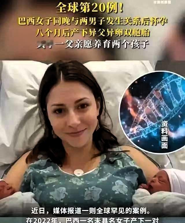 全球仅20例！巴西女子同一晚与2名男子发生了关系。不久后，女子后怀孕了，并且还生