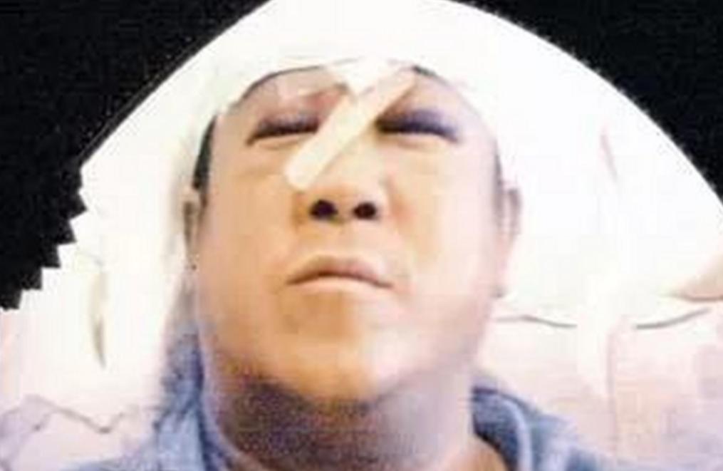 2001年，曾志伟刚从酒吧出来，就被几名壮汉狠揍了一顿。送医后，他被缝了29针，