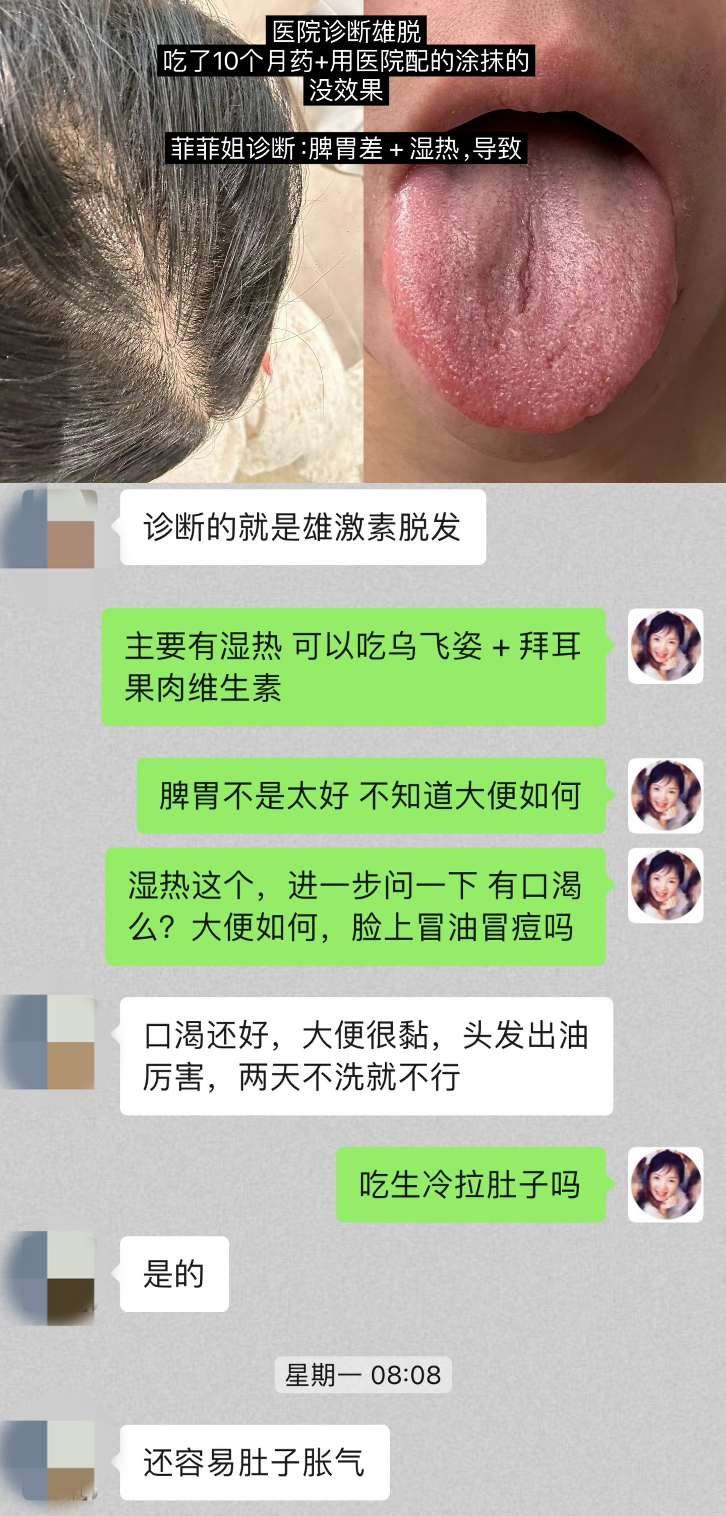 防脱发➕长头发·小分队，评论区扫码入最近频频收到姐妹吃“乌飞姿”的好效果。因为，