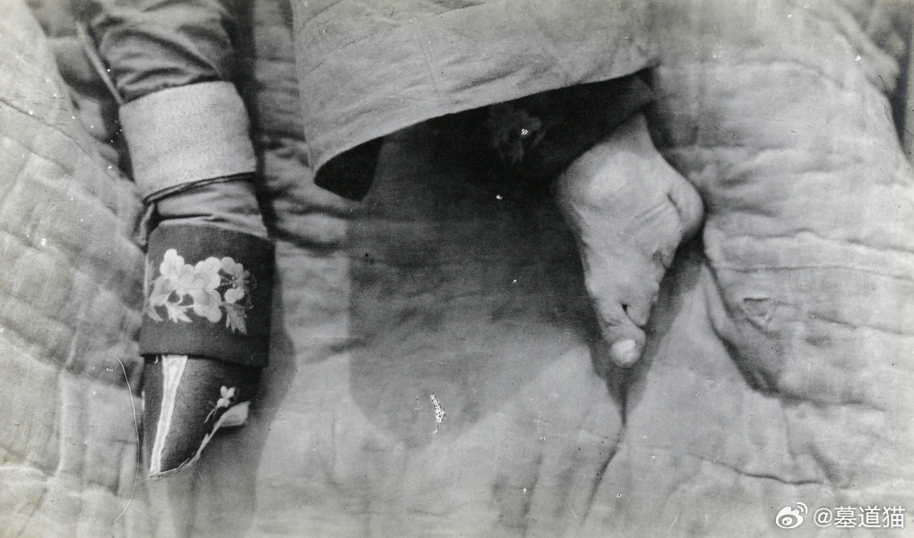 裹脚，1905年 ​​​