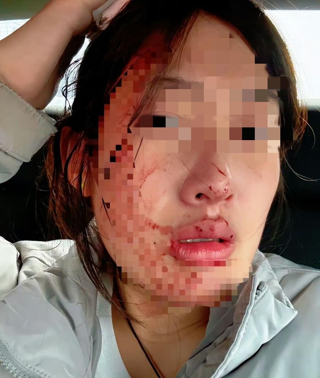 11月30日傍晚，
河北秦皇岛市第一医院，
涉事护士年仅23岁，刚参加工作不久。