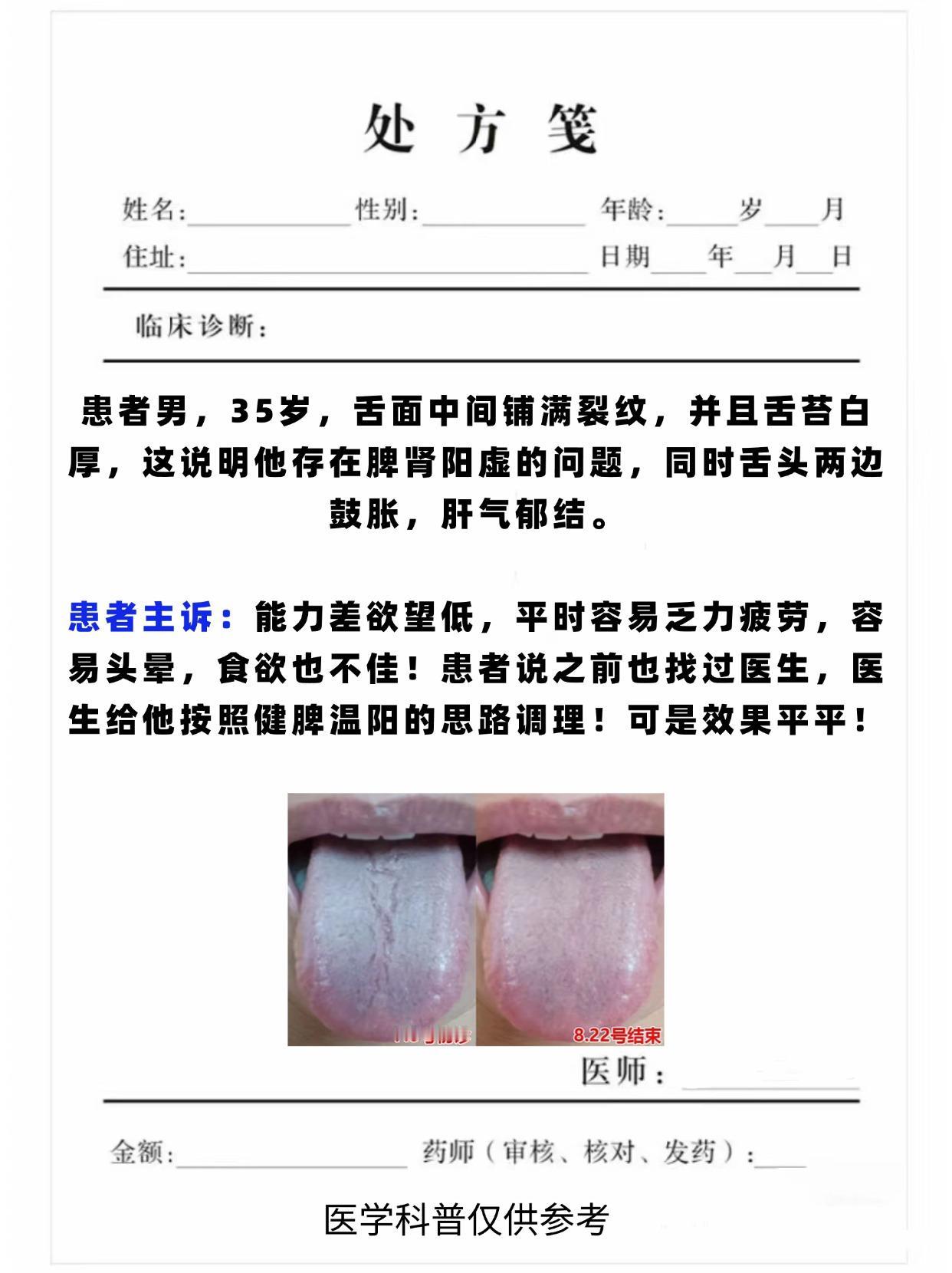 也就用了一招，舌头裂纹就消失了，其实裂纹舌一点都不难调！#科普##中医##涨知识