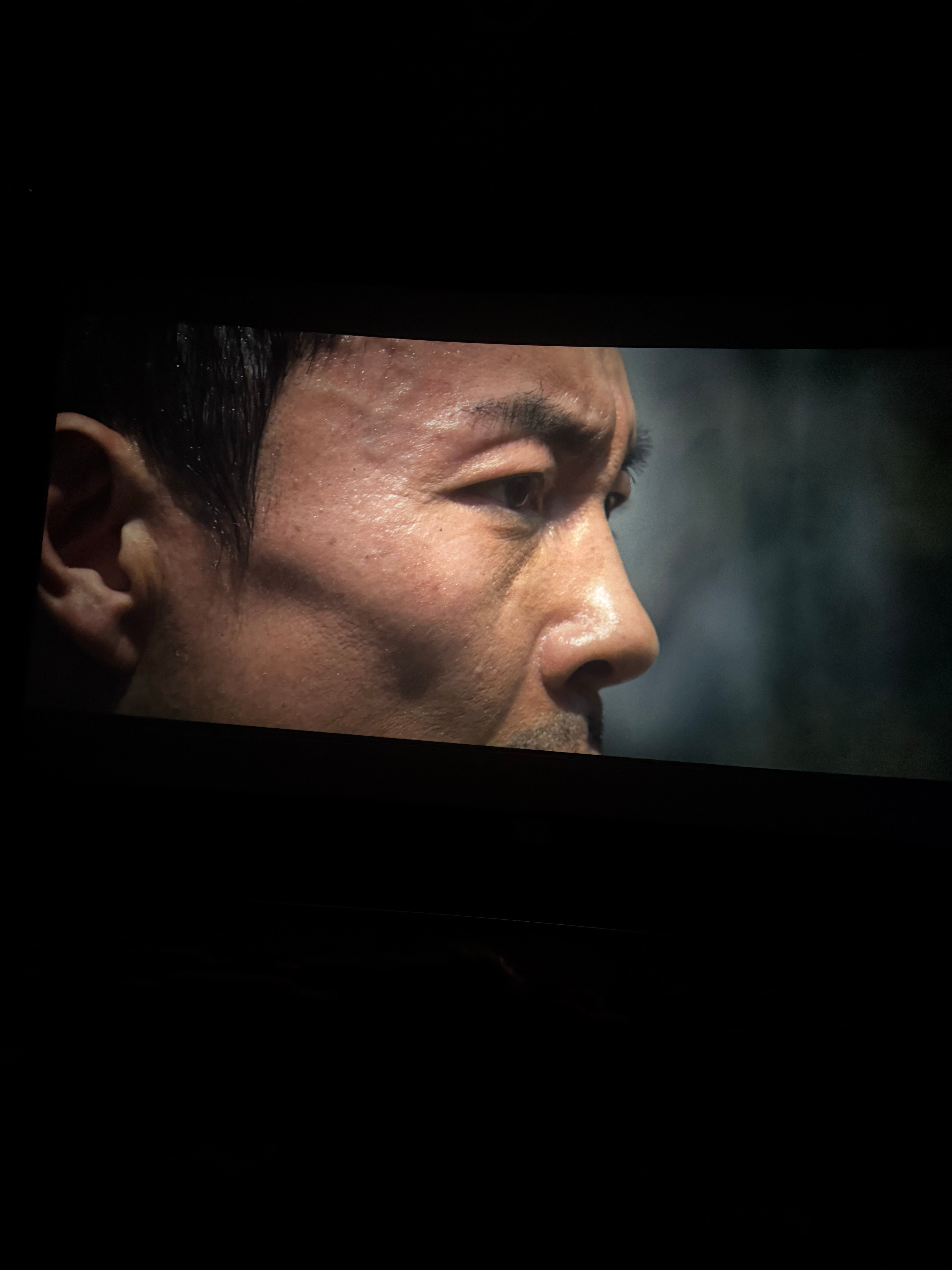 妹妹早上摔了个pg蹲，摔得可重了，手上腿上全是擦伤，pg 也都肿了。上午摔得，到