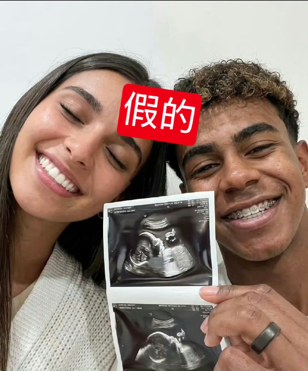 19岁亚马尔宣布女友怀孕 怀孕这个事是假的，没想到也能放出来！ 