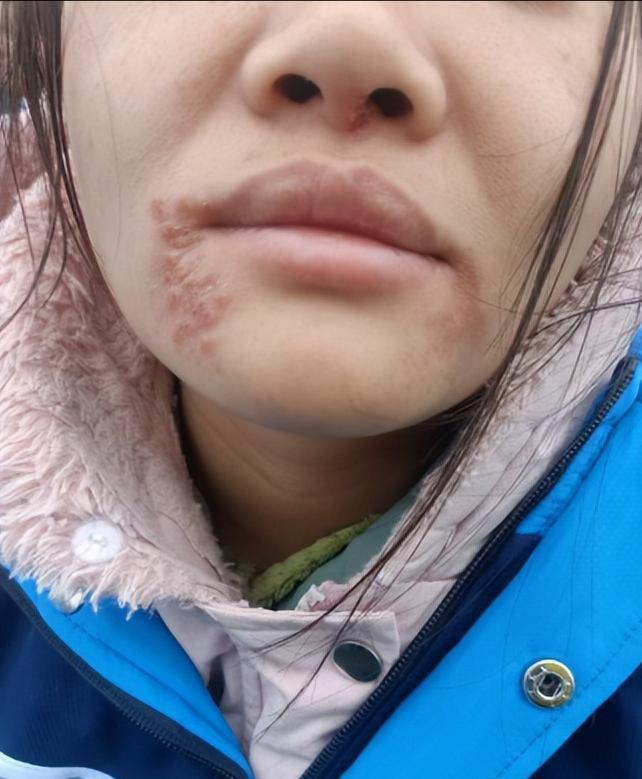 “太可怕了!”重庆一32岁女子被亲爸送去“拯救叛逆”的教育机构，囚禁虐待了4个月