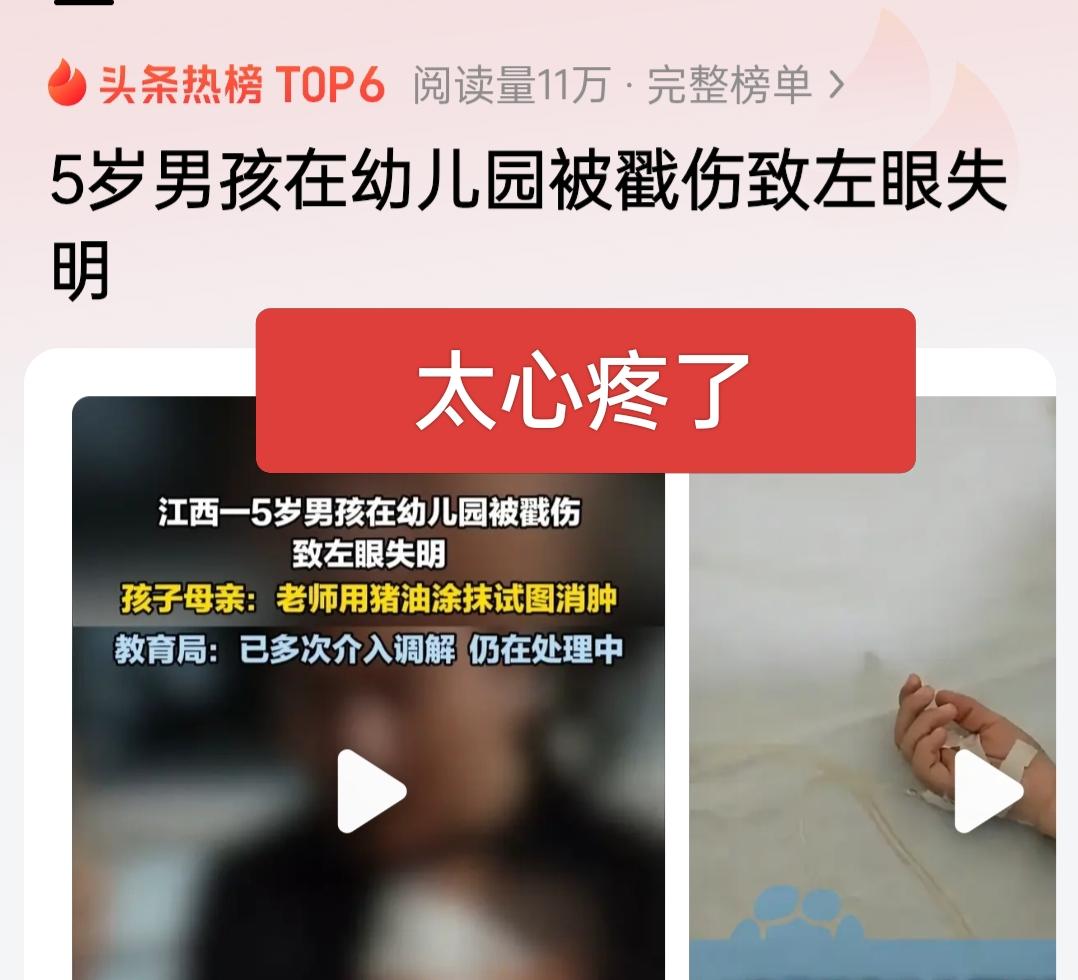 太心疼了！才5岁的孩子眼睛被戳伤致左眼失明！

这本不应该上热搜吧！孩子那么小，