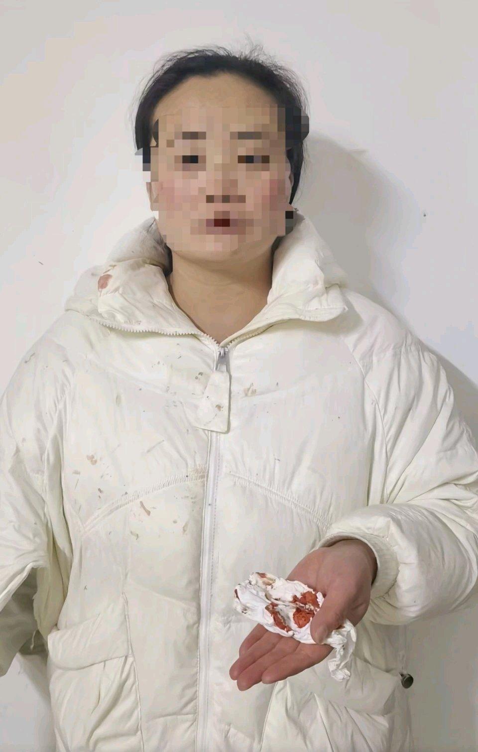 看到“女子结婚14年遭丈夫家暴13年”刑事自诉案一审宣判，被告人因虐待罪获刑6个