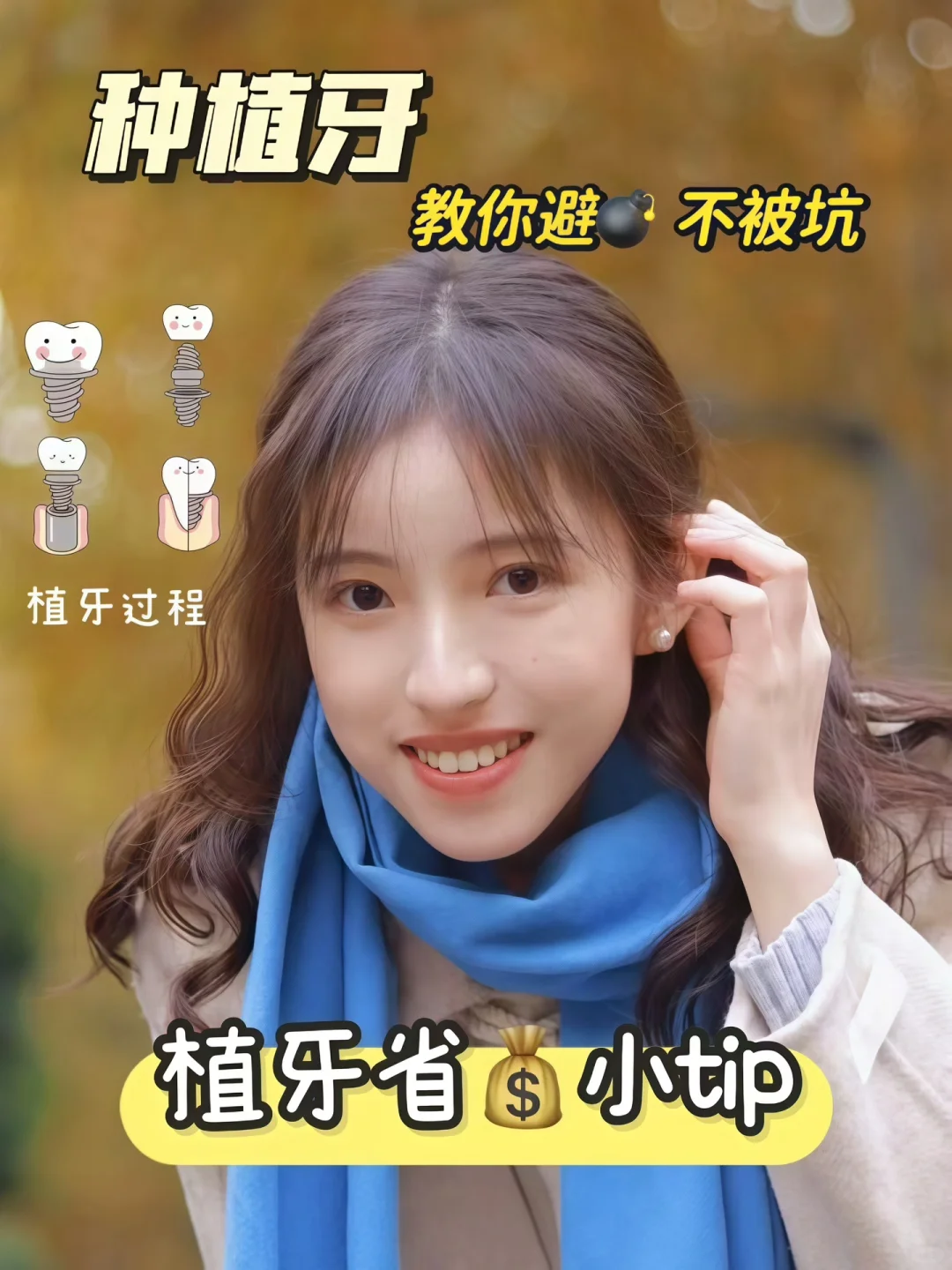 请大数据推给所有缺牙的姐妹（附植牙经验