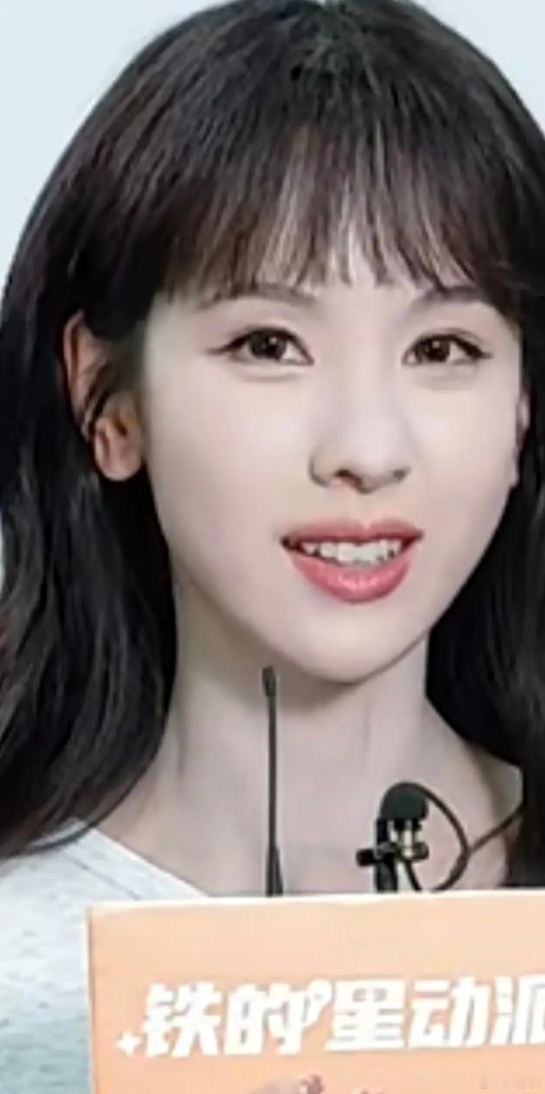 嘟这眼睛怎么这样 以前好像不这样什么医美项目被骗了其实我不太理解她的化妆师 这不